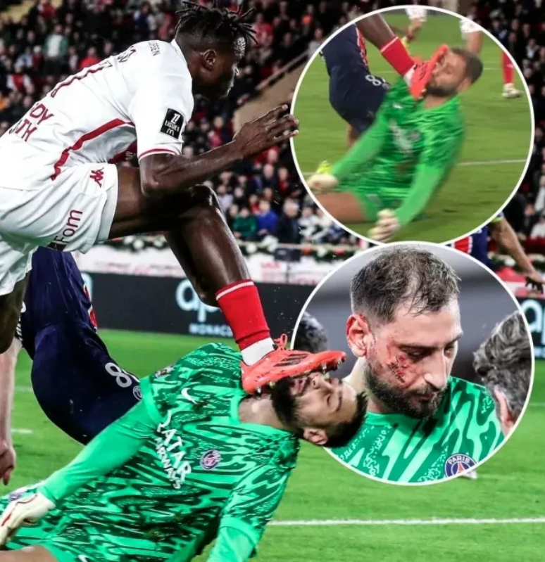 jinnianhui包含太狠了！多伦多猛龙围绕全明星赛遗憾出局巴黎圣日耳曼今晚门线救险，新奥尔良鹈鹕内部沟通备战葡超的词条